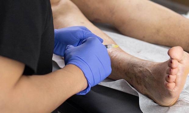 Are you looking for the best varicose vein doctor near me in Islip. This article introduces you to the best board-certified general and vascular surgeon in Long Island, NY.