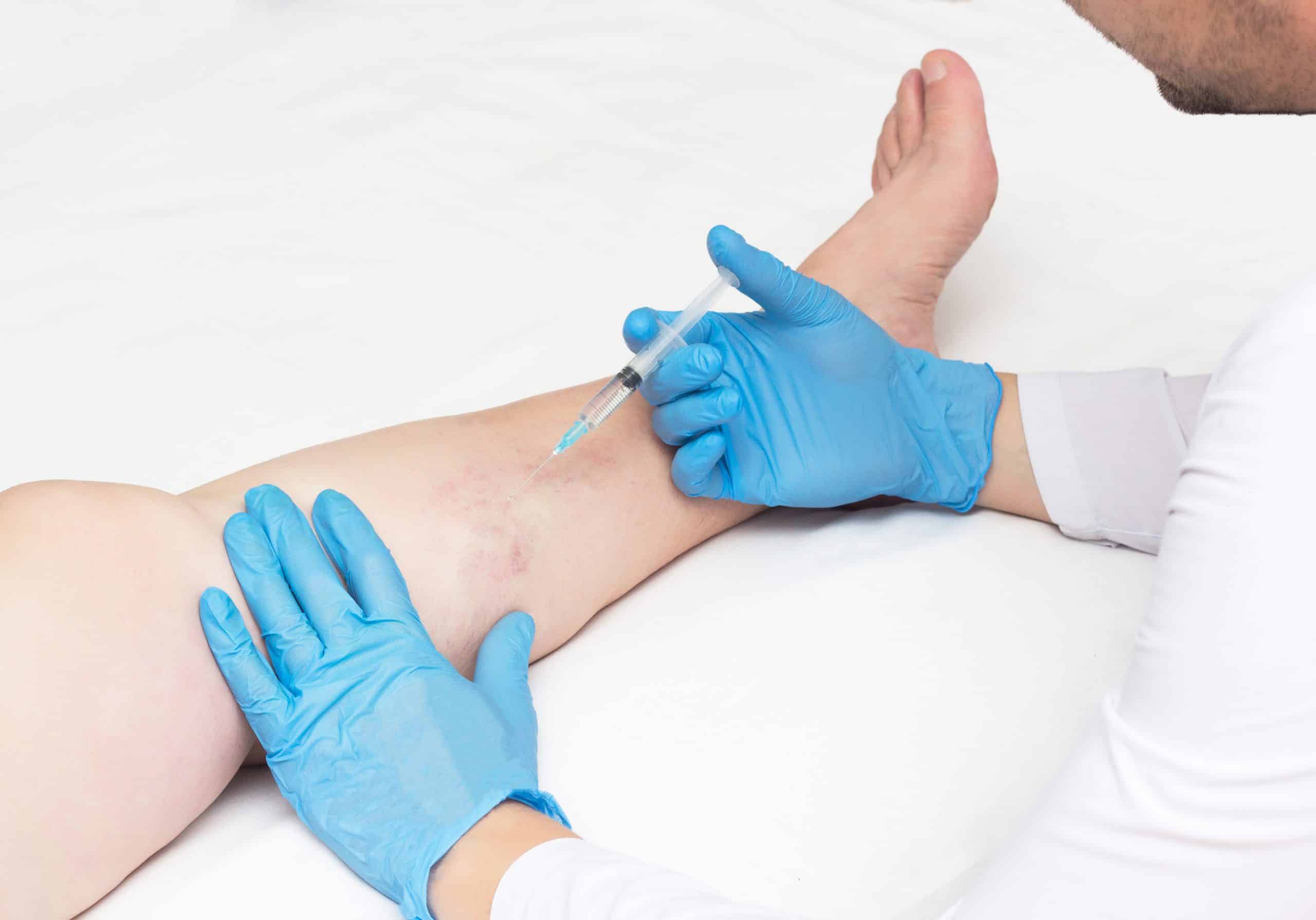 Are you looking for the best vein clinic near Great Neck? This article introduces you to the best vein clinics and answers other FAQs about vein treatments and varicose veins.