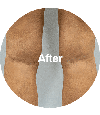 BEFORE_AFTER_2-min BEFORE_AFTER-min