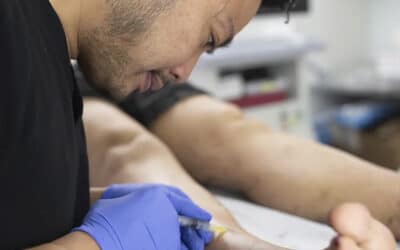 What Is a Chronic Venous Insufficiency Medical Procedure?